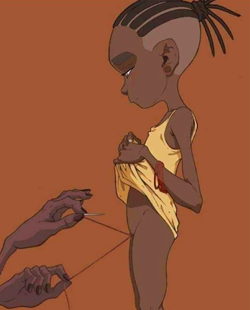 La mutilación genital femenina